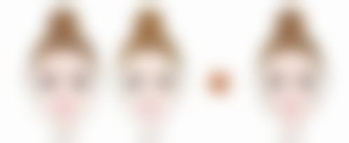 耳软骨隆鼻缺点有哪些——耳软骨易变形，你的鼻子可能会“跑偏”