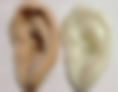 辽阳恒隆嘉俪医疗美容门诊部顾客实例