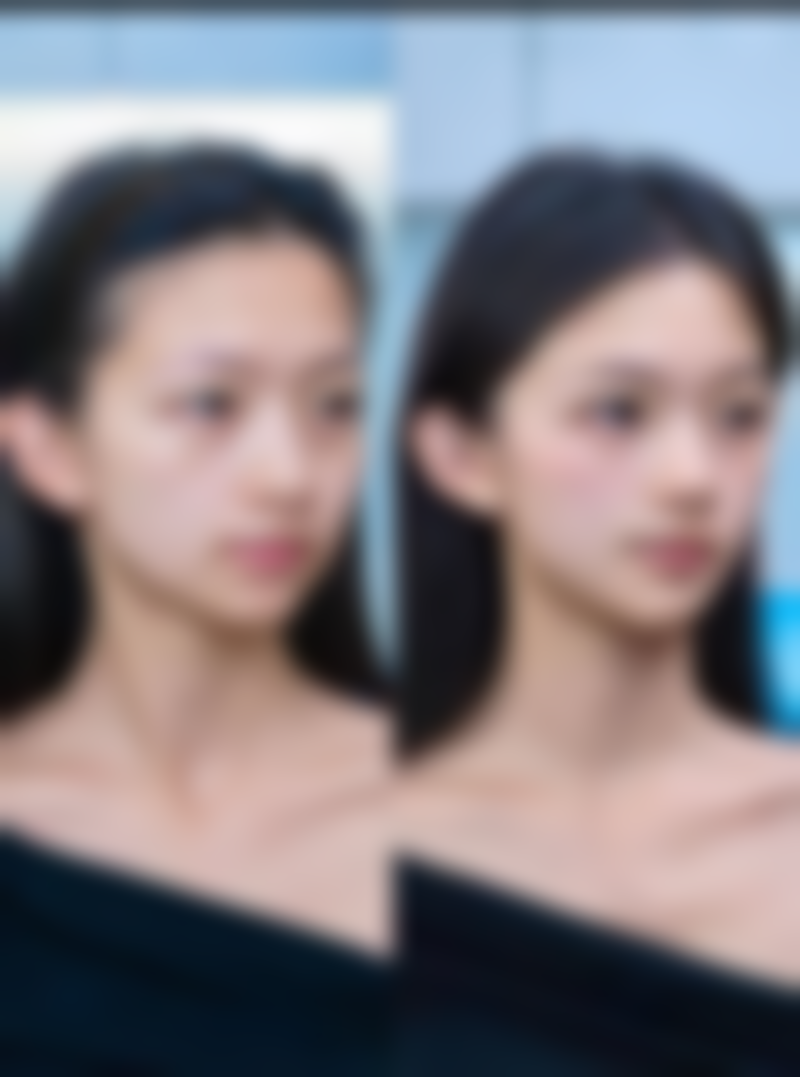 甲状腺手术后有疤痕增生的就医时机