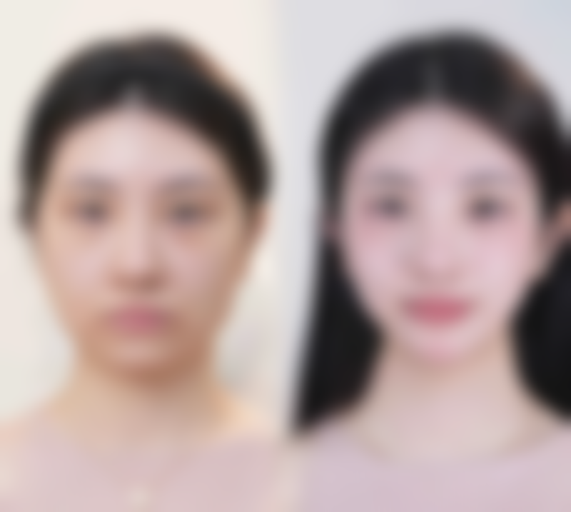 衡阳微美娜医疗美容抖音团购活动有哪些，价格表