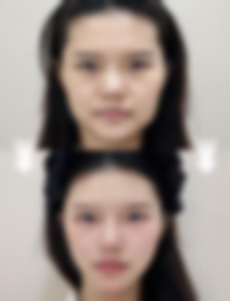 孙文强医生简介做手术价格