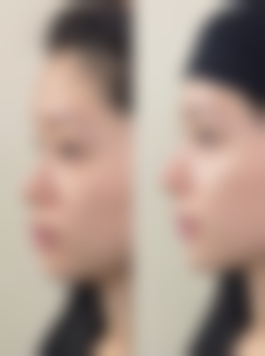 杨四维医生简介做手术价格