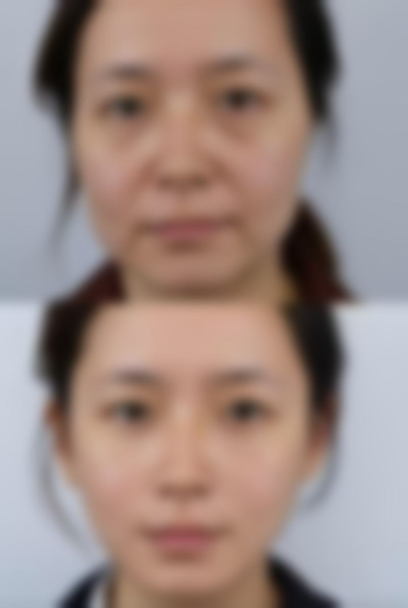 杨四维医生简介项目优势