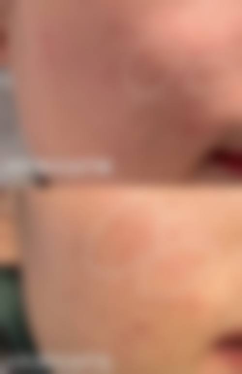 泰国Bangkok曼谷整形外科诊所价格表