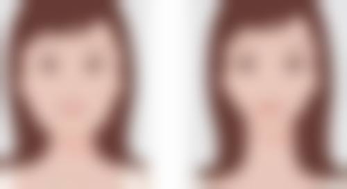 泰国Bangkok曼谷整形外科诊所评价