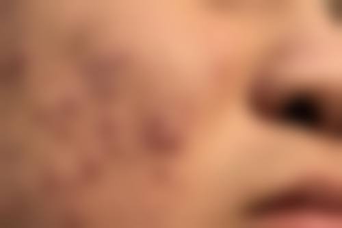 德阳东美奥拉克整形医院项目特色