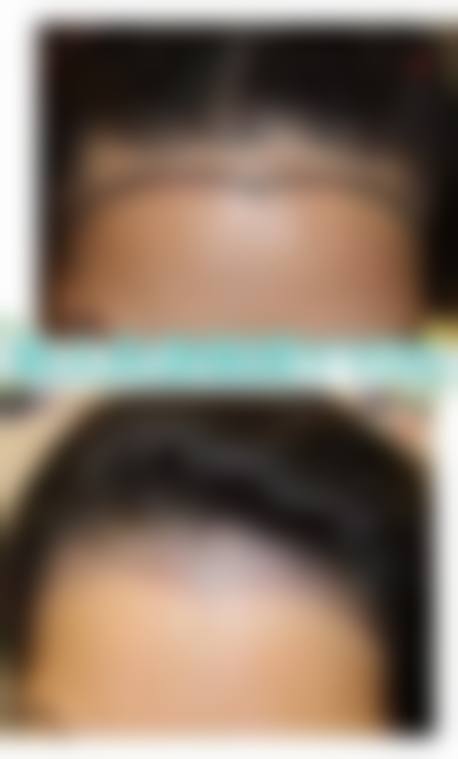 深圳（惠州）倍生植发正规吗