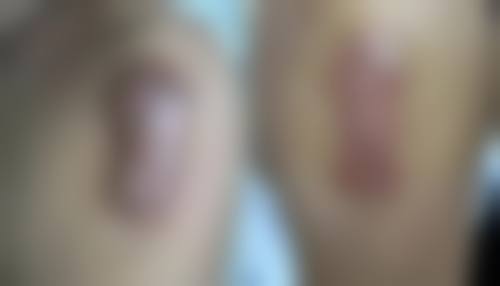 肇庆市第一人民医院烧伤整形科医生简介