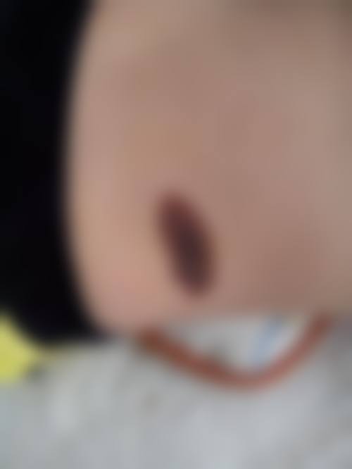 南京维脂（丽科）医疗美容诊所怎么样，评价