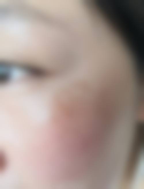 龚细平医生怎么挂号