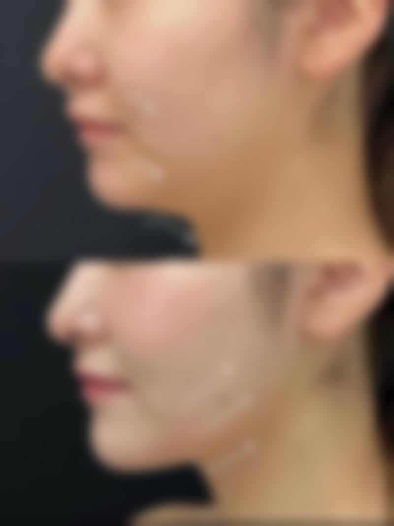 陈突医生顾客实例图片