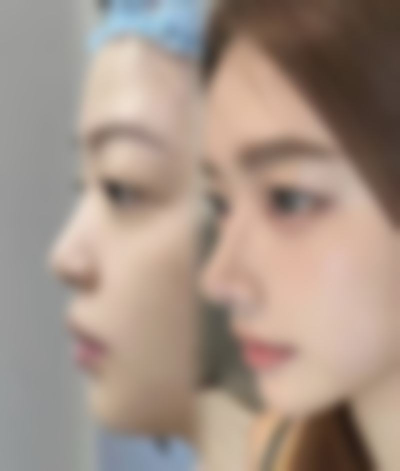 西安壹加壹医疗美容医院(西北旗舰店)价格表