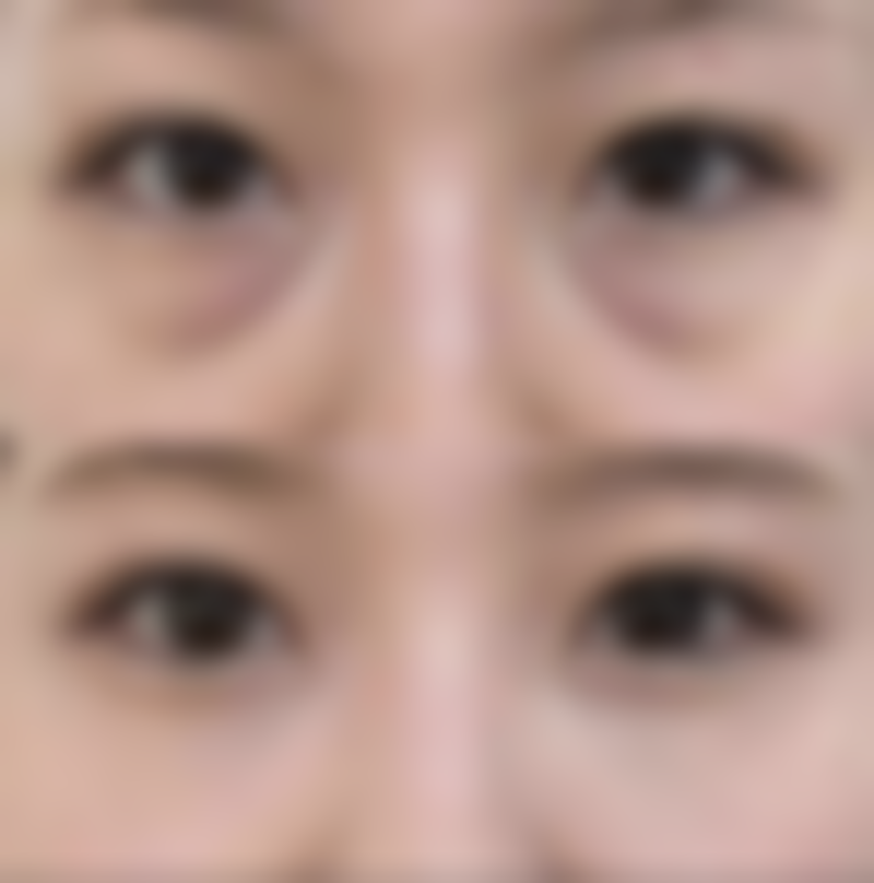 陈突医生做手术价格