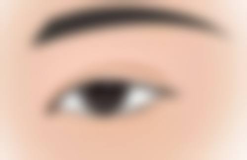 刘锋医生简介做手术价格