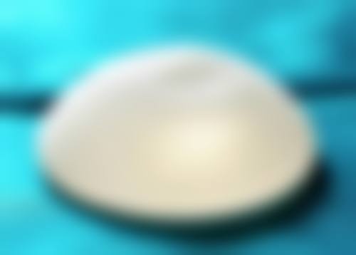 隆胸假体取出会有什么后果之胸部凹陷：皮肤的“记忆床单”