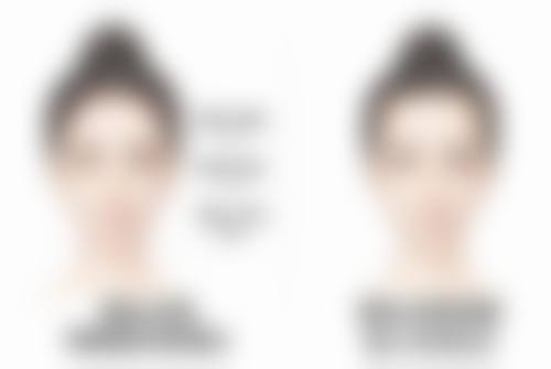 隆胸修复期是多长时间——术后护理的“加速秘籍大揭秘”