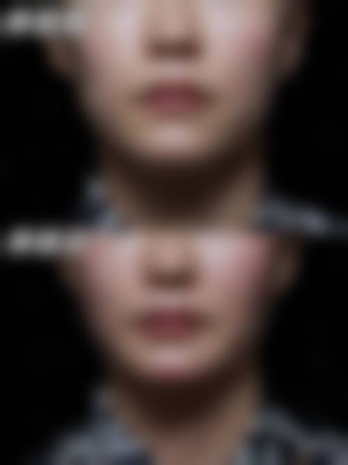 昆明璞妍医疗美容门诊部怎么样，顾客实例反馈