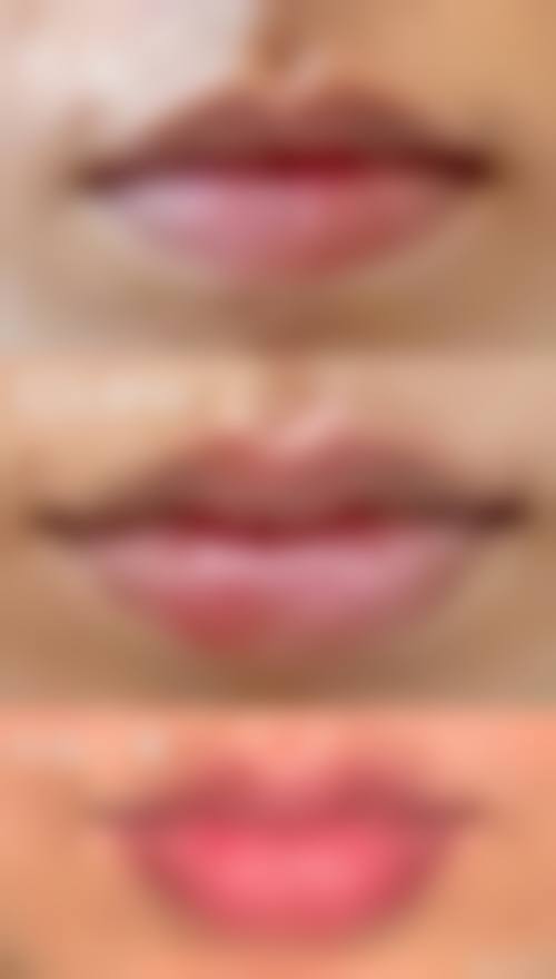 台安溪朵整形医院价格表