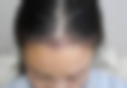 阜阳黛莱美整形医院怎么样项目特色