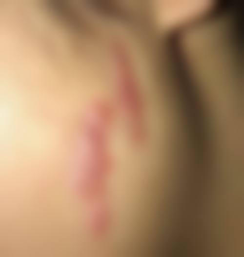 广州市信永门诊部顾客实例