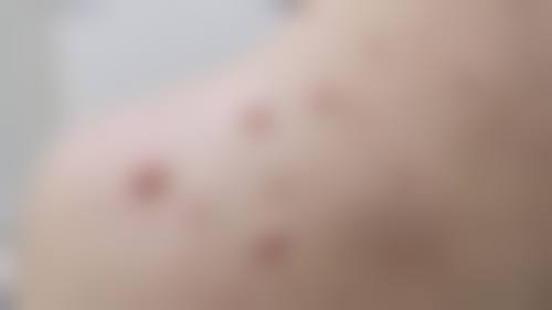 熊永田医生项目优势