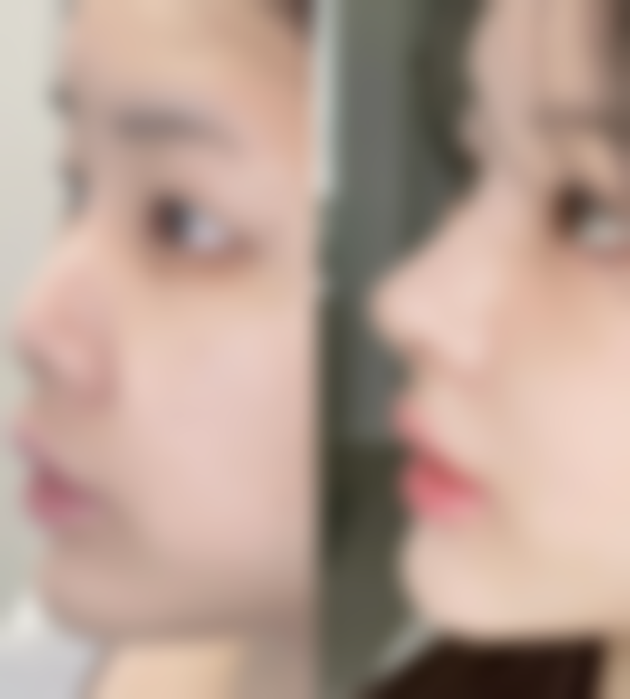 熊永田医生顾客实例成效