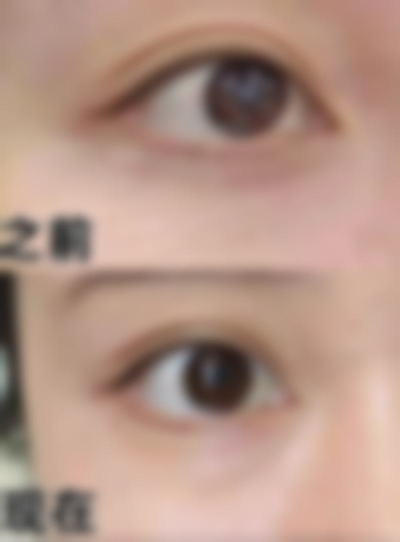 刘锋医生简介项目优势