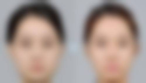 张会生医生简介口碑如何