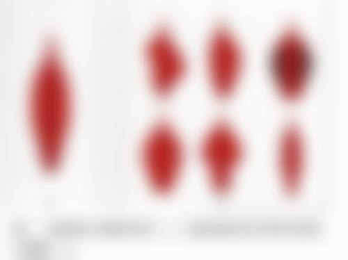 杭州瑞丽天鸽整形外科门诊部特色项目怎么样