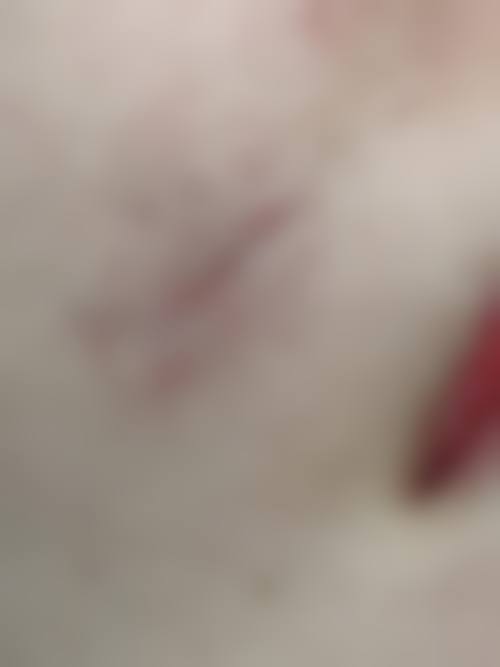 西安晶肤皮肤美容门诊部怎么样,顾客实例分享