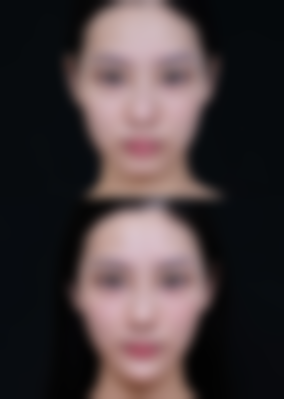 武汉某医院——针剂有保护的微整形科室