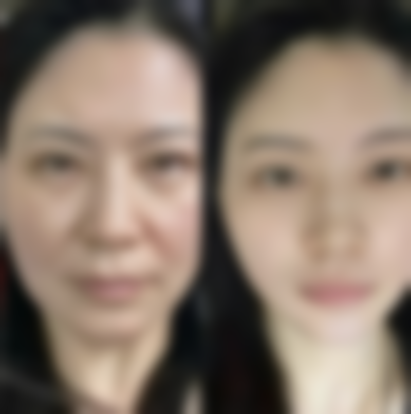 张会生医生简介做手术价格