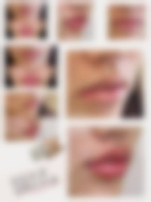 武汉斯启诺医疗美容门诊部叶锋排名第几位——武汉美莱医疗美容医院