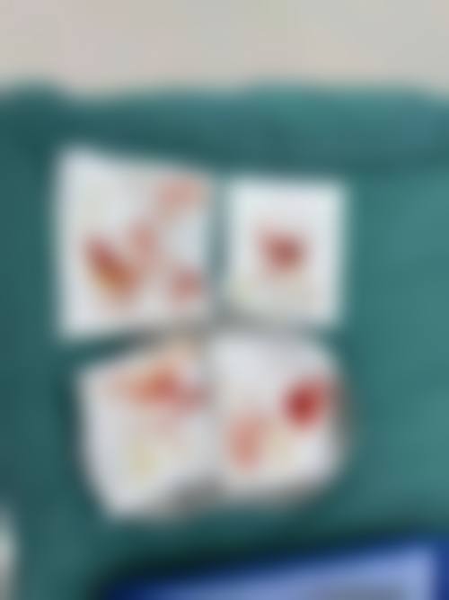 邢台媚思嘉医疗美容门诊部顾客实例