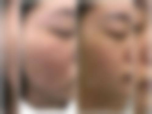 谭宏月医生顾客实例图片