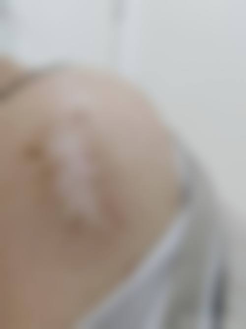 武汉碧莲盛医疗美容门诊部更擅长什么