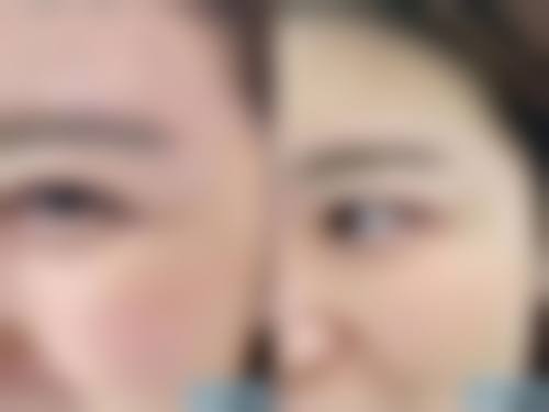 怎么可以价格合理地臀部抽脂：费用明细大公开