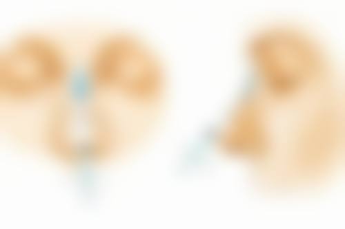 钱瑾医生谈膨体隆鼻一般修复时长