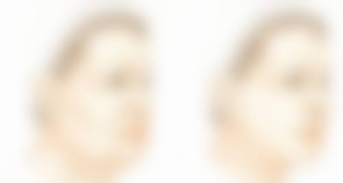 眼睛热敷去眼袋的注意事项