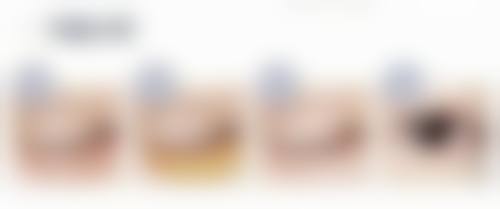 埋线双眼皮术后护理好能管多少年:保养秘籍大公开