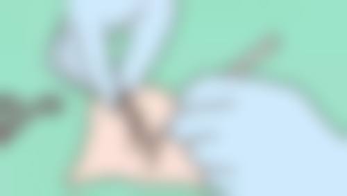 许昌正美韶华医疗美容诊所8000元切开双眼皮的未来发展