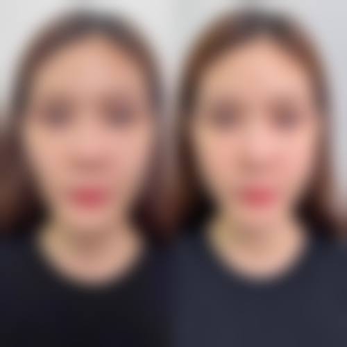 林德捷医生简介项目优势