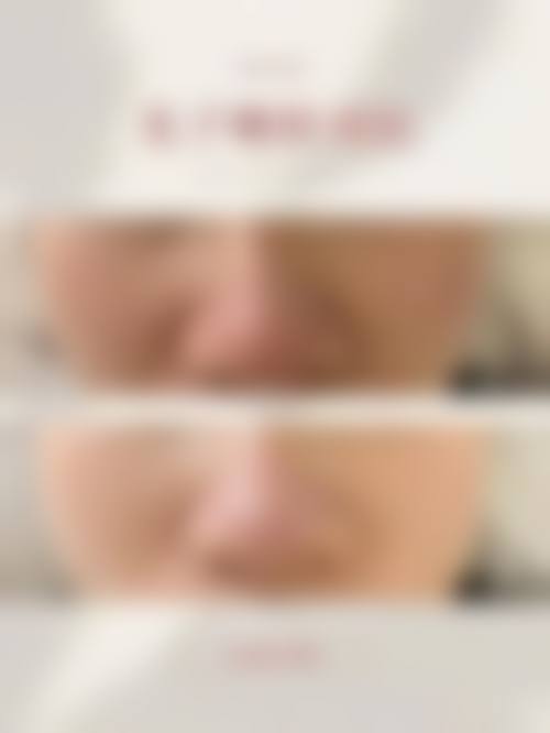 深圳妍熙妍医疗美容门诊部资质