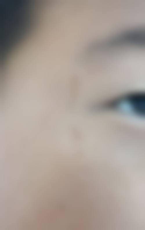 呼和浩特伊思医疗美容门诊部顾客实例