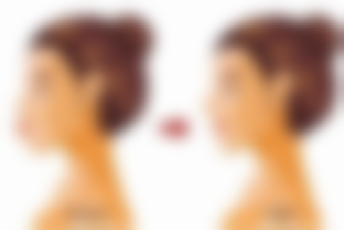 黎小妮医生项目优势