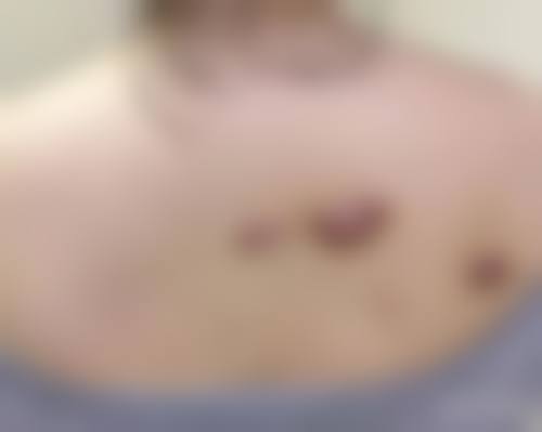 冯露葳医生怎么挂号