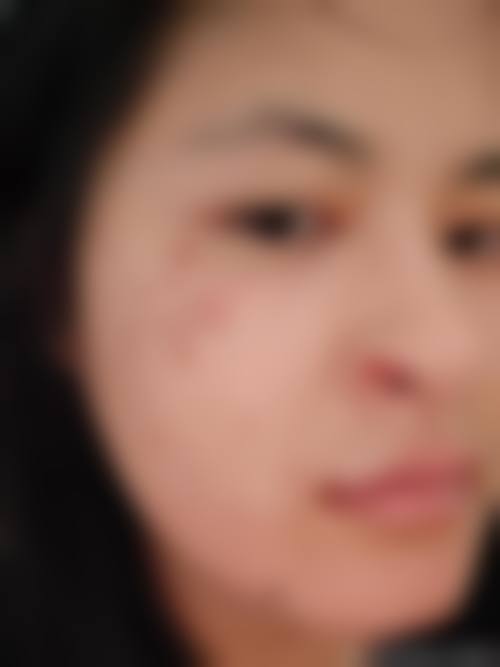 刘文艳医生简介医生顾客实例图片：实际成效见证实力