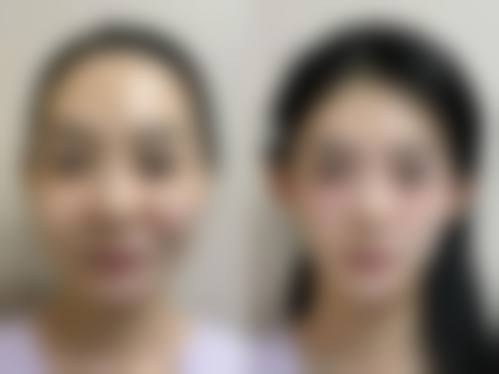 广州中山大学附属第一医院价格表