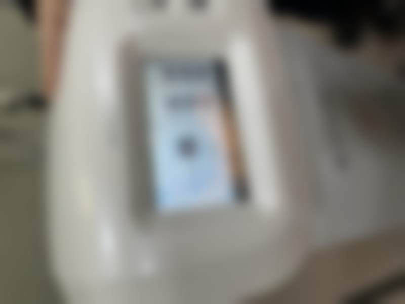 S女性医院李惠妍手术成功几率——北京协和医院