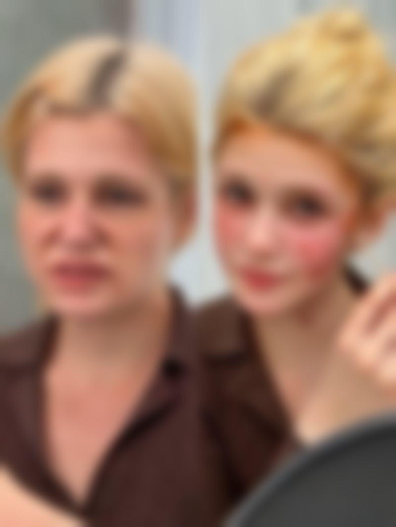 七毫米双眼皮成内双后修复的可能性与方法